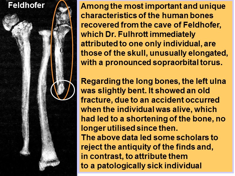 Feldhofer Among the most important and unique characteristics of the human bones recovered from